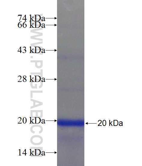 JARID2 fusion protein Ag24536 SDS-PAGE