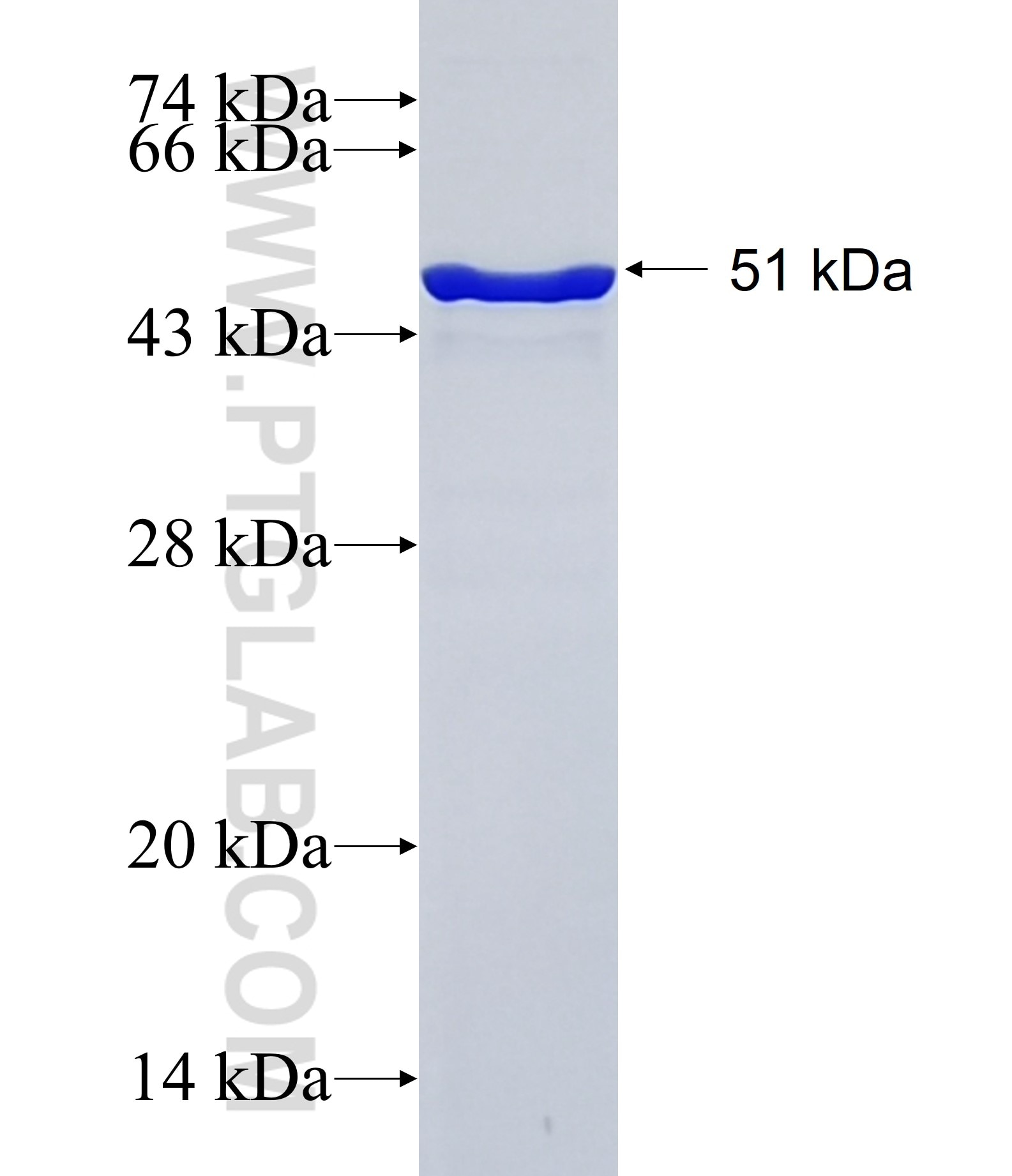 JARID2 fusion protein Ag34738 SDS-PAGE