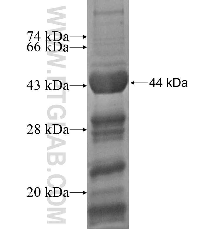 JARID2 fusion protein Ag16618 SDS-PAGE