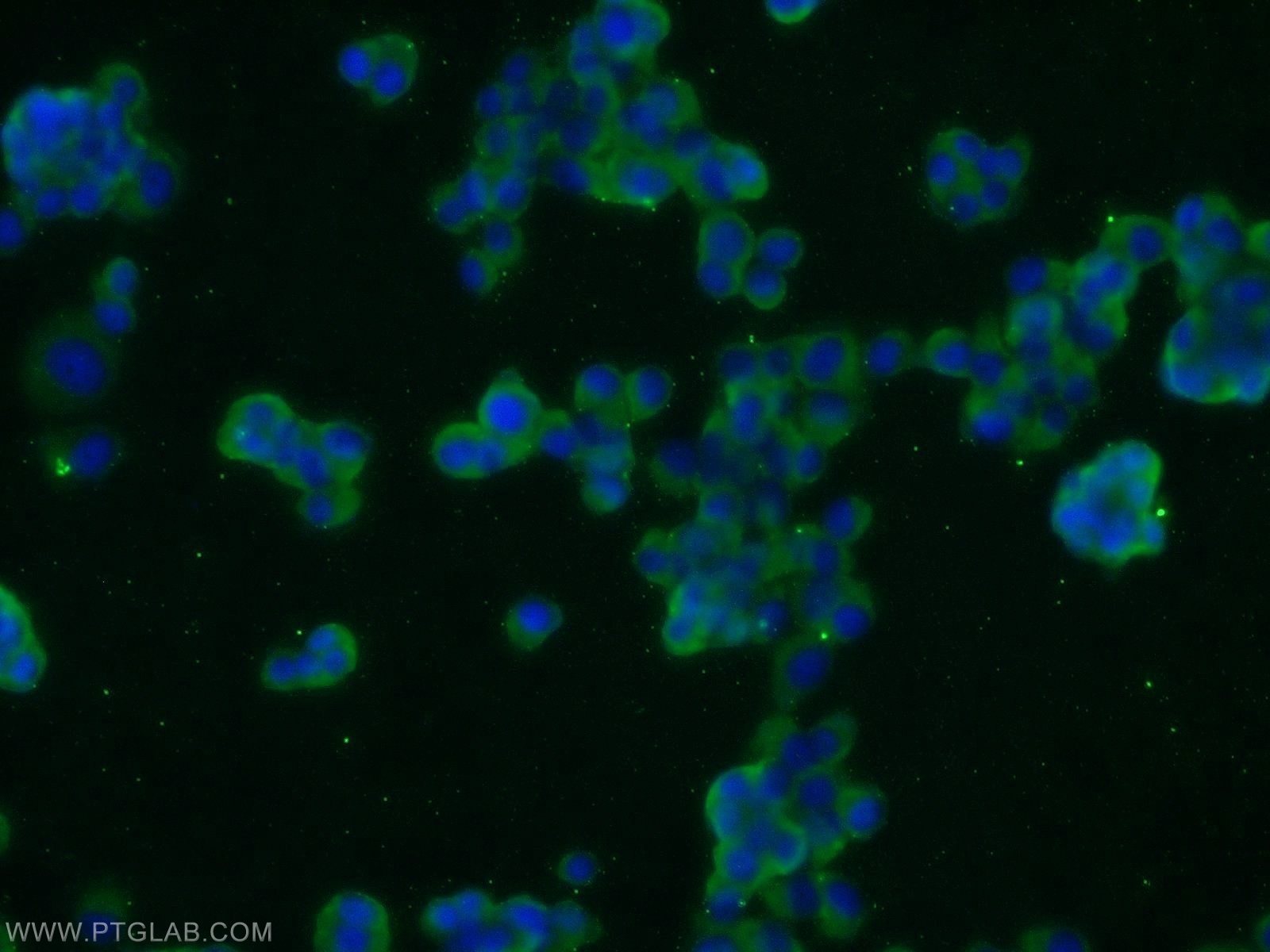 Immunofluorescence (IF) / fluorescent staining of PC-12 cells using JIP1/IB-1 Polyclonal antibody (14568-1-AP)