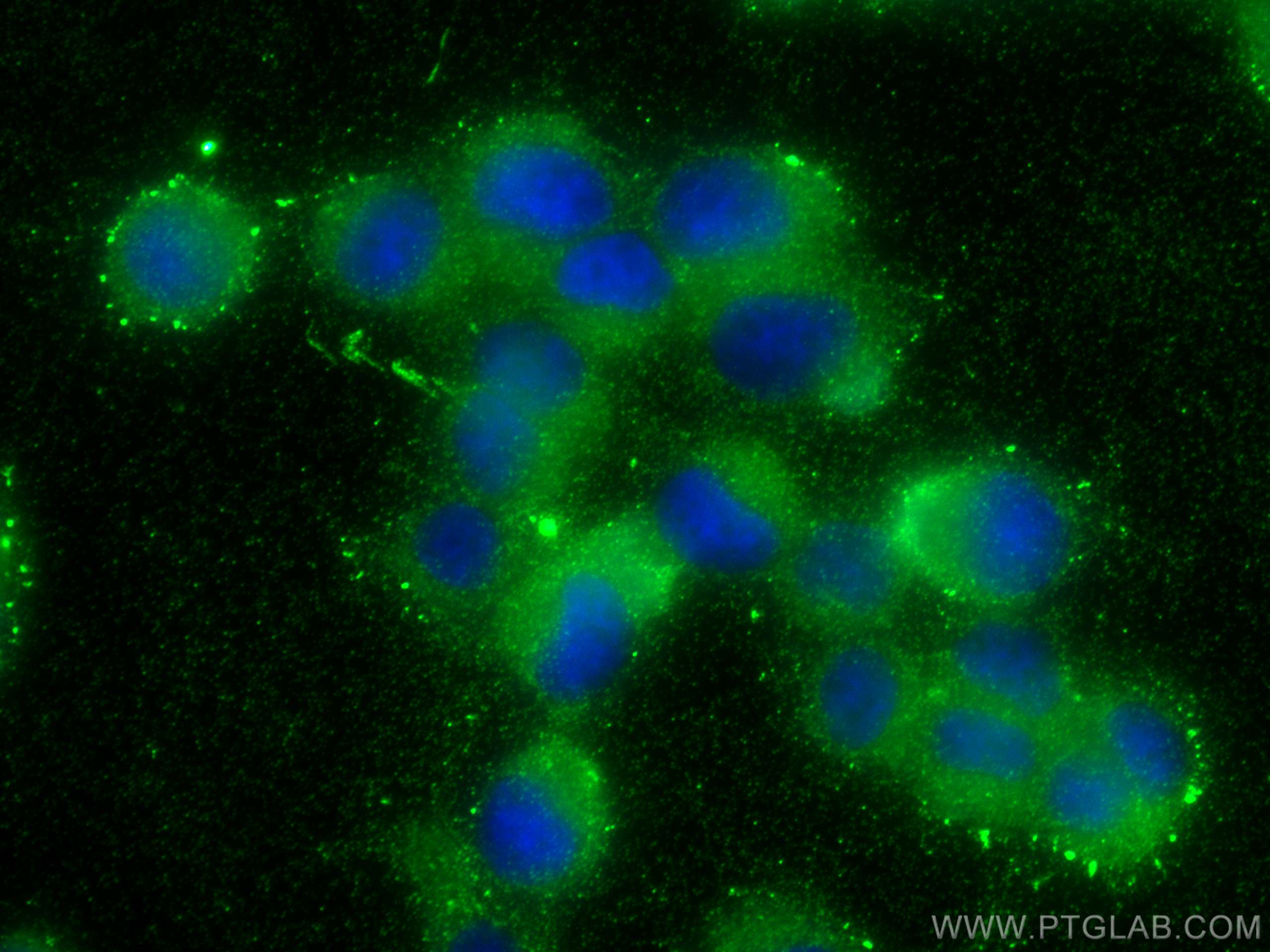 Immunofluorescence (IF) / fluorescent staining of PC-12 cells using JIP1/IB-1 Polyclonal antibody (14568-1-AP)