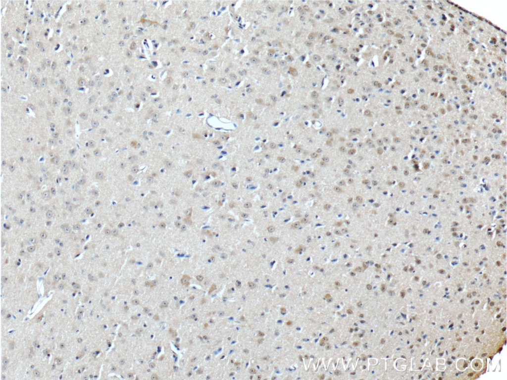 Immunohistochemistry (IHC) staining of mouse brain tissue using JIP1/IB-1 Polyclonal antibody (14568-1-AP)