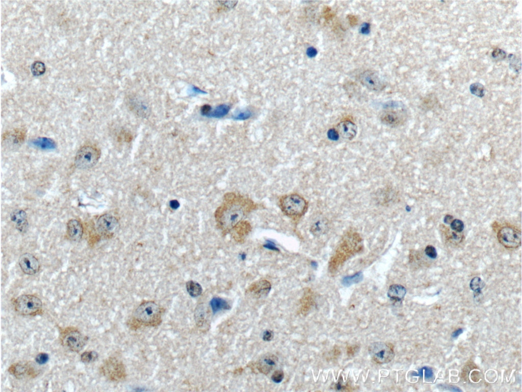 Immunohistochemistry (IHC) staining of mouse brain tissue using JIP1/IB-1 Polyclonal antibody (14568-1-AP)