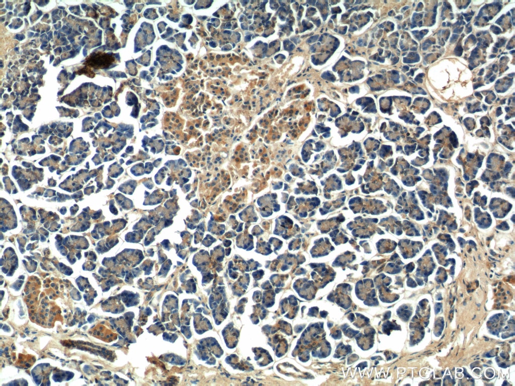 Immunohistochemistry (IHC) staining of human pancreas tissue using JIP1/IB-1 Polyclonal antibody (14568-1-AP)