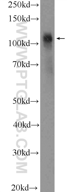 Western Blot (WB) analysis of fetal human brain tissue using JIP1/IB-1 Polyclonal antibody (14568-1-AP)