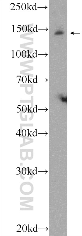 Western Blot (WB) analysis of rat brain tissue using JIP3 Polyclonal antibody (25212-1-AP)