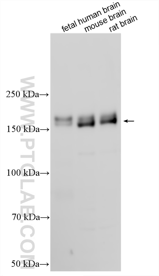 Western Blot (WB) analysis of various lysates using JIP3 Polyclonal antibody (25212-1-AP)