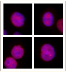 JMJD2B / KDM4B antibody (pAb) tested by Immunofluorescence. Formaldehyde fixed HeLa cells stained with JMJD2B / KDM4B antibody at a 1:2,000 dilution.