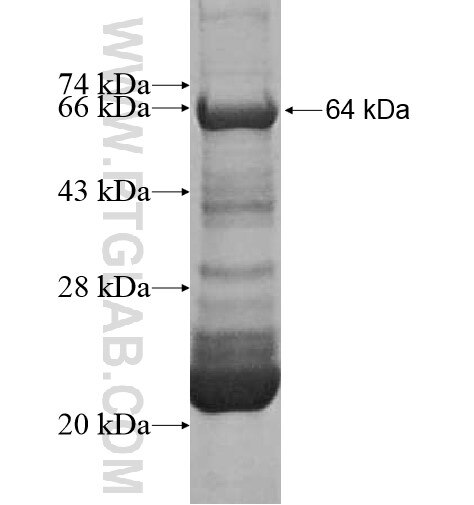 JMJD4 fusion protein Ag16099 SDS-PAGE