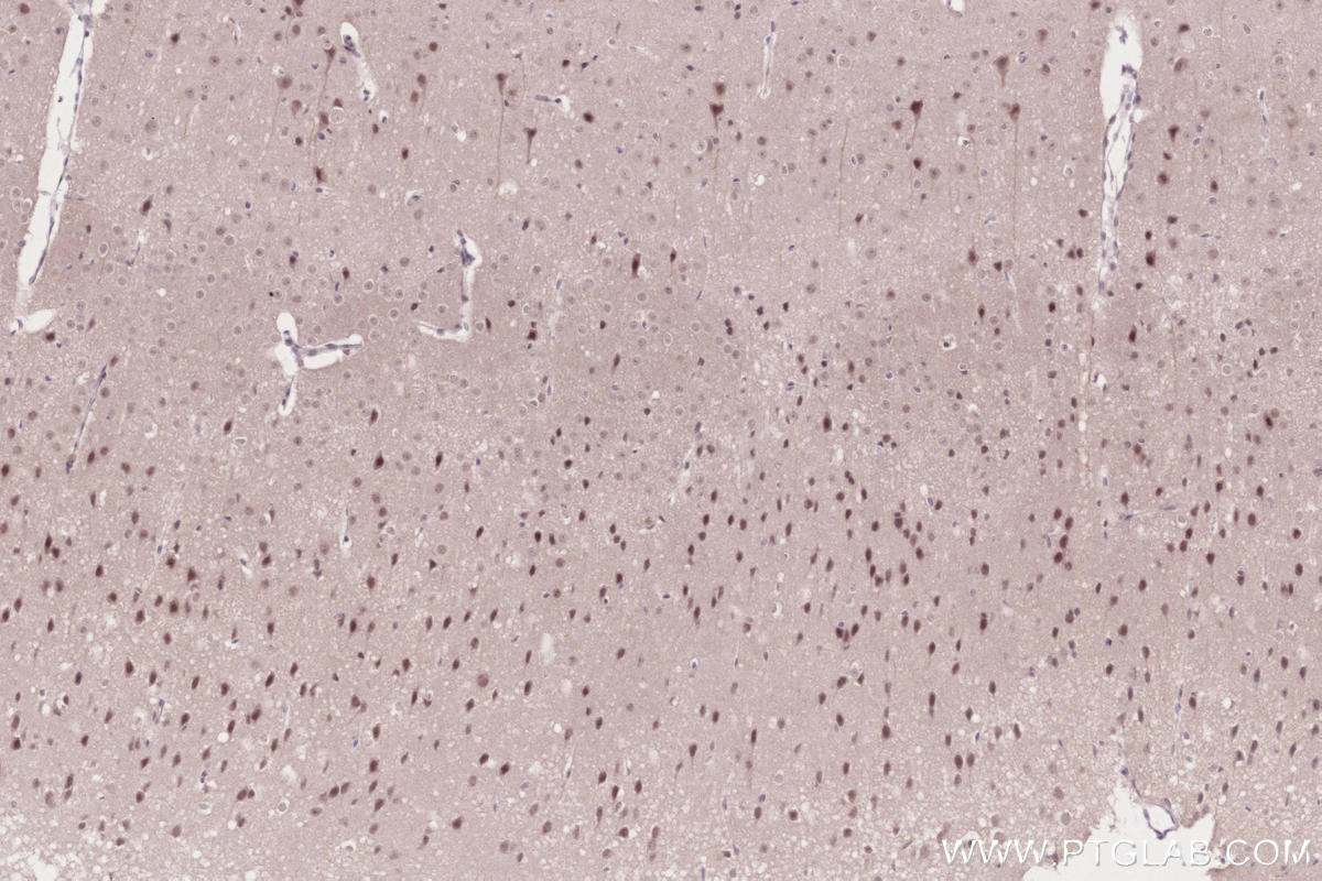 Immunohistochemistry (IHC) staining of mouse brain tissue using JMJD5 Recombinant monoclonal antibody (84804-4-RR)