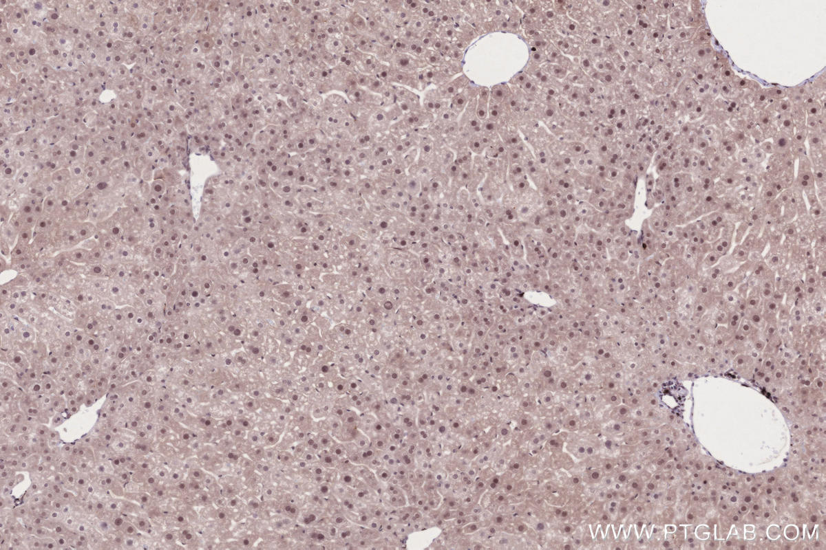 Immunohistochemistry (IHC) staining of mouse liver tissue using JMJD5 Recombinant monoclonal antibody (84804-4-RR)