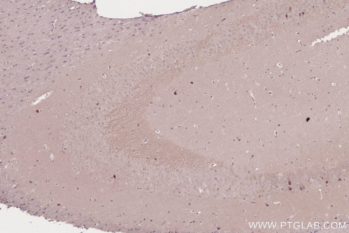 Immunohistochemistry (IHC) staining of mouse brain tissue using JMJD5 Recombinant monoclonal antibody (84804-4-RR)