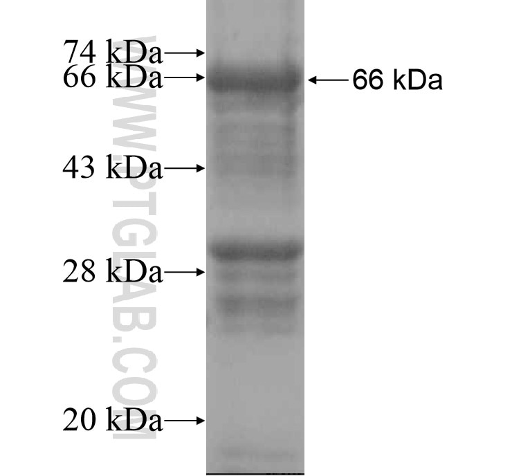 JMJD5 fusion protein Ag15115 SDS-PAGE