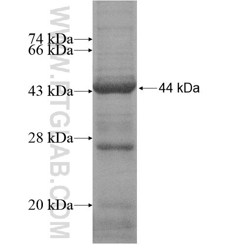 JMJD5 fusion protein Ag15256 SDS-PAGE