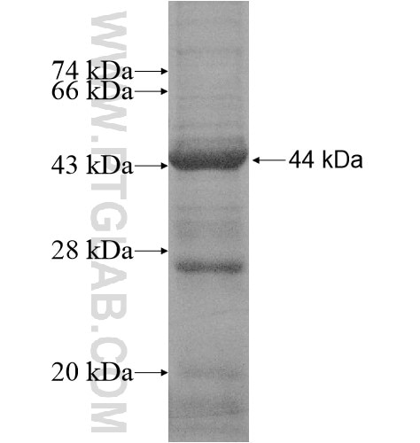 JMJD5 fusion protein Ag15256 SDS-PAGE