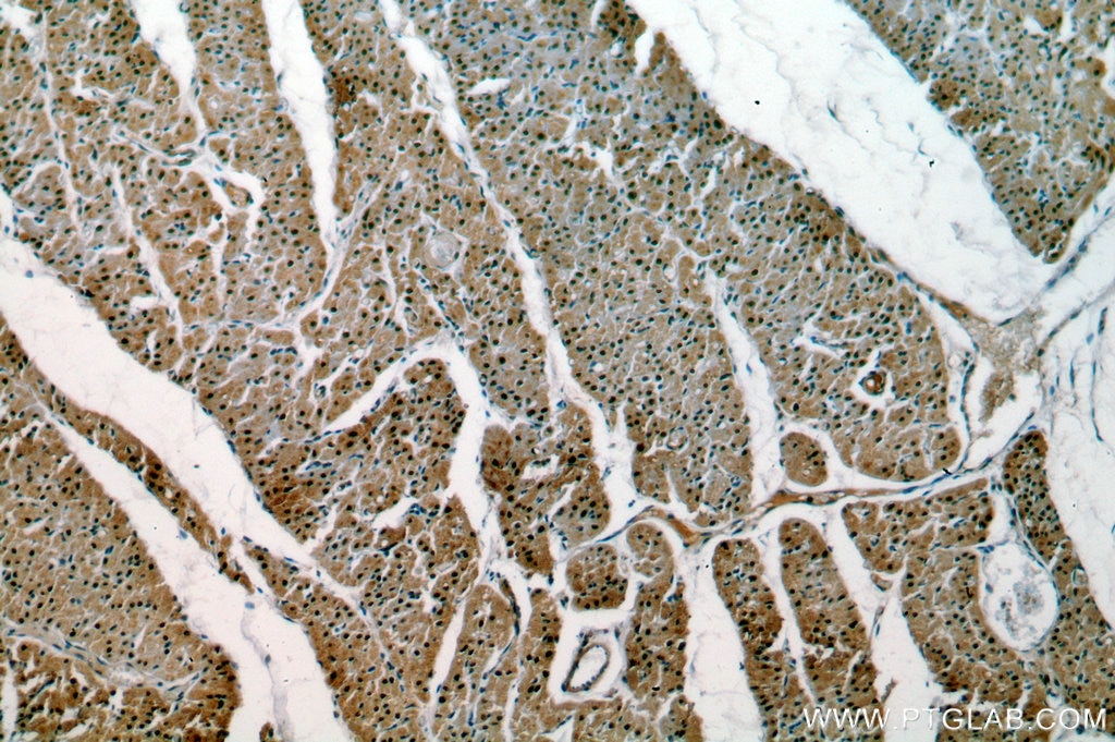 IHC staining of human heart using 16476-1-AP