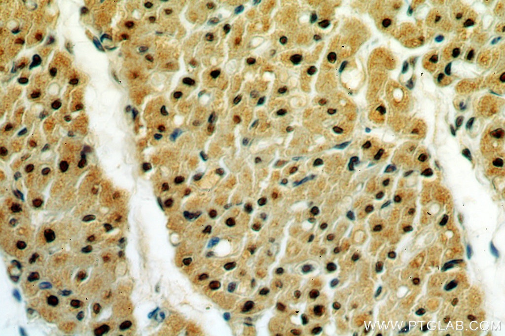Immunohistochemistry (IHC) staining of human heart tissue using JMJD6 Polyclonal antibody (16476-1-AP)