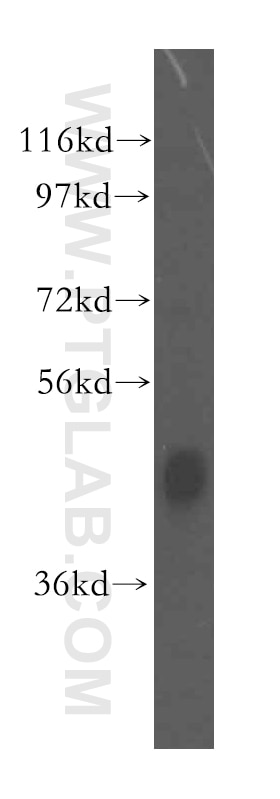 Western Blot (WB) analysis of mouse liver tissue using JMJD6 Polyclonal antibody (16476-1-AP)