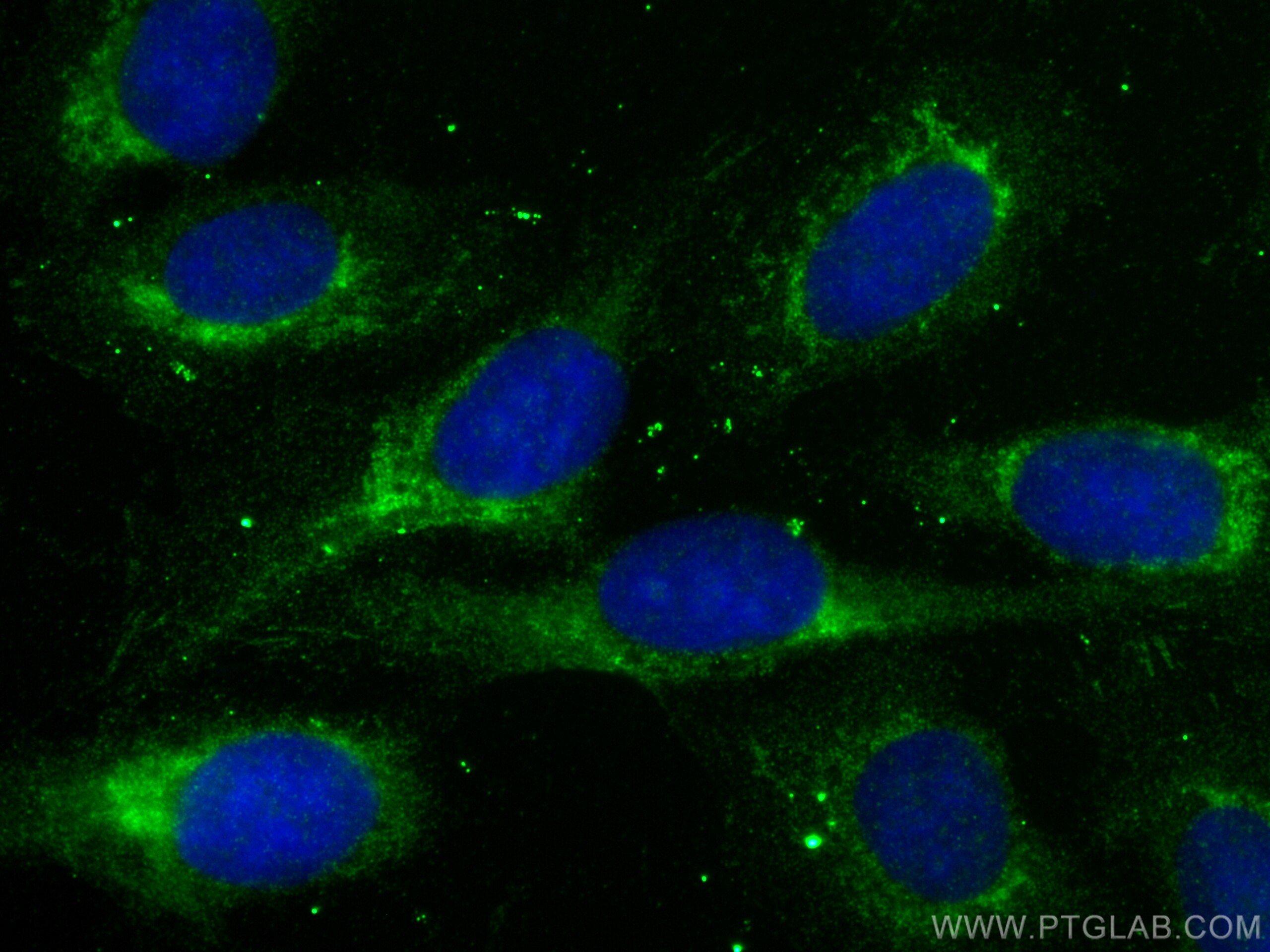 Immunofluorescence (IF) / fluorescent staining of U2OS cells using JMJD7 Polyclonal antibody (21168-1-AP)