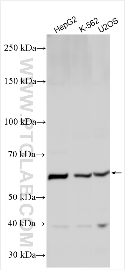 Western Blot (WB) analysis of various lysates using JMJD7 Polyclonal antibody (21168-1-AP)