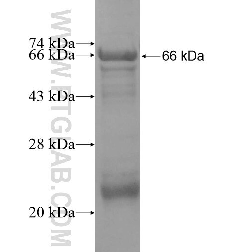 JMJD7 fusion protein Ag15371 SDS-PAGE
