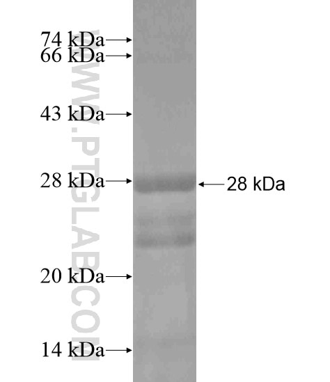 JMJD8 fusion protein Ag19682 SDS-PAGE