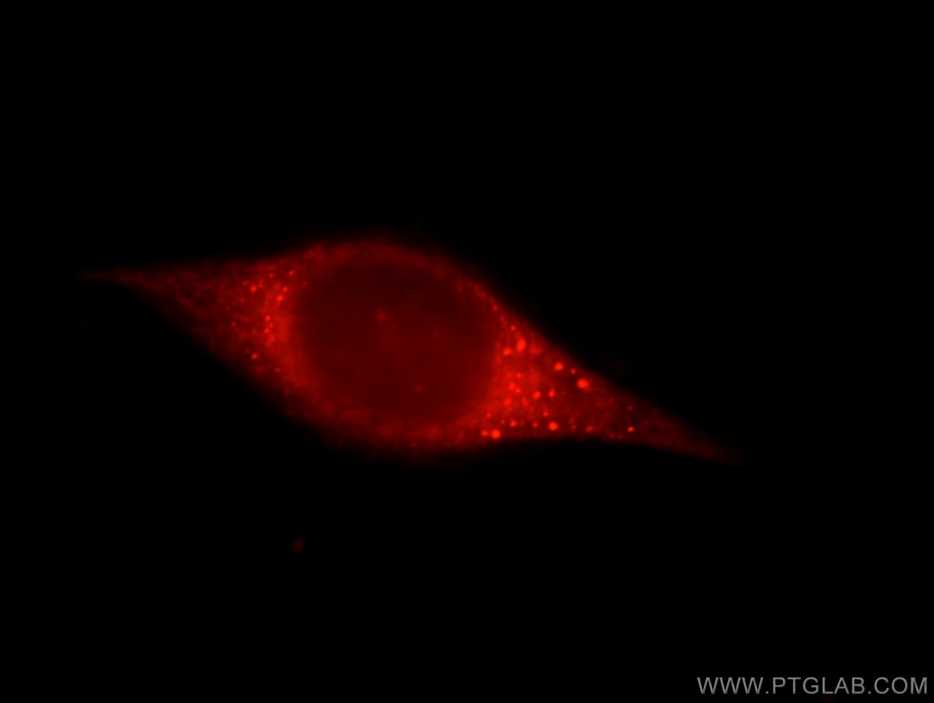 Immunofluorescence (IF) / fluorescent staining of HeLa cells using JMY Polyclonal antibody (25098-1-AP)