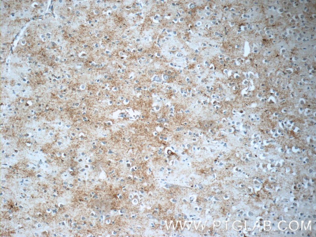 Immunohistochemistry (IHC) staining of human brain tissue using JMY Polyclonal antibody (25098-1-AP)