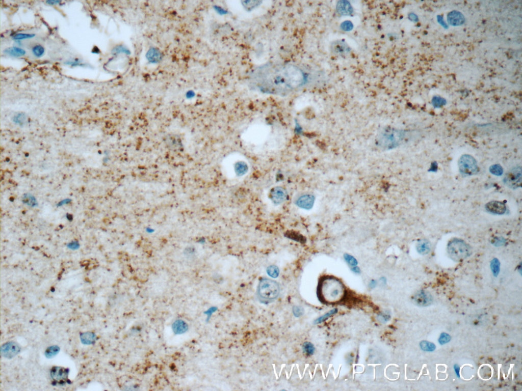 Immunohistochemistry (IHC) staining of human brain tissue using JMY Polyclonal antibody (25098-1-AP)