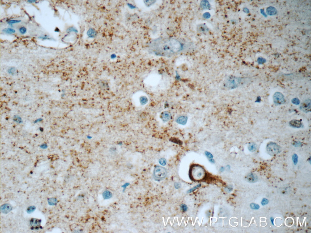 Immunohistochemistry (IHC) staining of human brain tissue using JMY Polyclonal antibody (25098-1-AP)