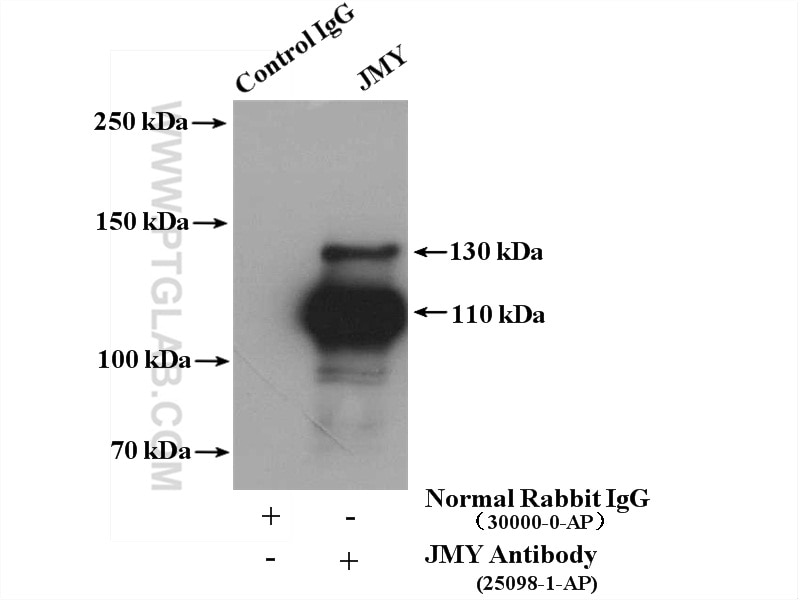 Immunoprecipitation (IP) experiment of Jurkat cells using JMY Polyclonal antibody (25098-1-AP)
