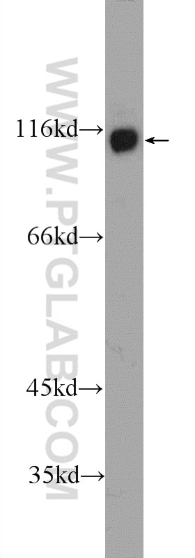 Western Blot (WB) analysis of Jurkat cells using JMY Polyclonal antibody (25098-1-AP)