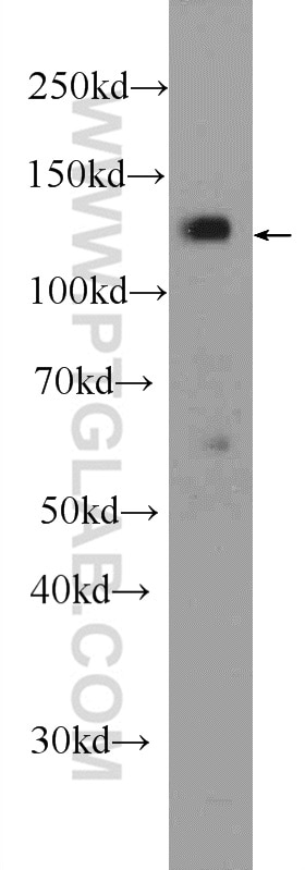 Western Blot (WB) analysis of HeLa cells using JMY Polyclonal antibody (25098-1-AP)