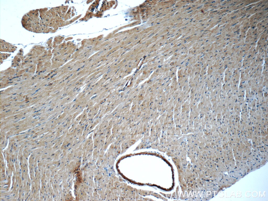 Immunohistochemistry (IHC) staining of mouse heart tissue using JNK Polyclonal antibody (10023-1-AP)