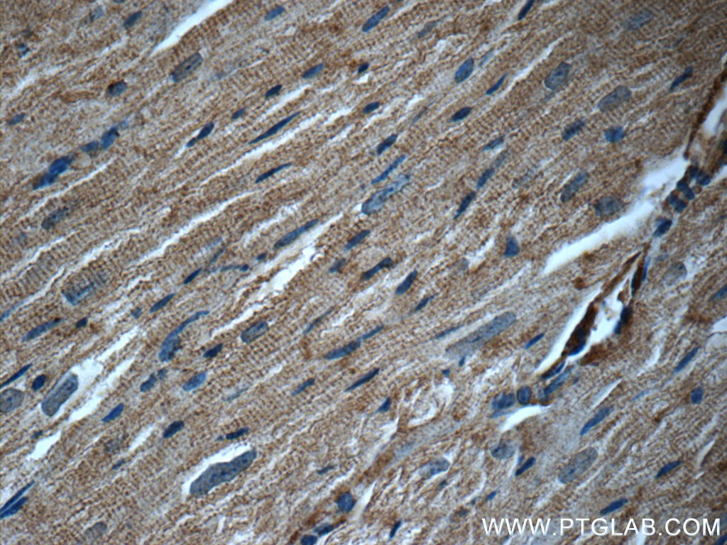 Immunohistochemistry (IHC) staining of mouse heart tissue using JNK Polyclonal antibody (10023-1-AP)