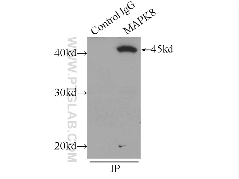 JNK Polyclonal antibody