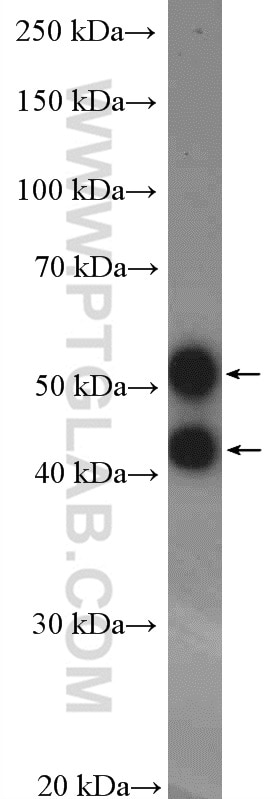 Western Blot (WB) analysis of Jurkat cells using JNK Polyclonal antibody (10023-1-AP)