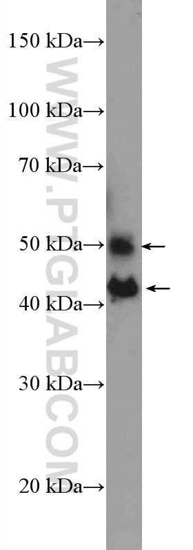 Western Blot (WB) analysis of MCF-7 cells using JNK Polyclonal antibody (10023-1-AP)