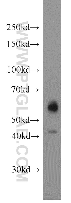 Western Blot (WB) analysis of HEK-293 cells using JNK Polyclonal antibody (10023-1-AP)