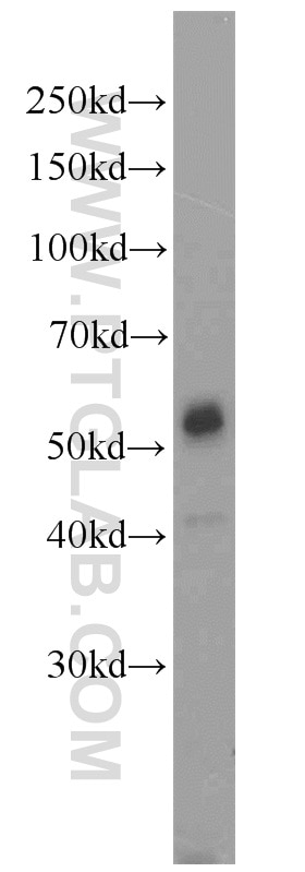 Western Blot (WB) analysis of SH-SY5Y cells using JNK Polyclonal antibody (10023-1-AP)