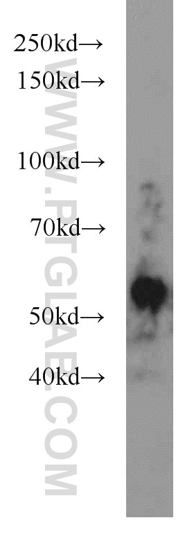 Western Blot (WB) analysis of A431 cells using JNK Polyclonal antibody (10023-1-AP)