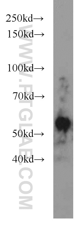 WB analysis of A431 using 10023-1-AP