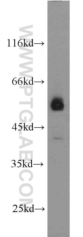 Western Blot (WB) analysis of HeLa cells using JNK Polyclonal antibody (10023-1-AP)