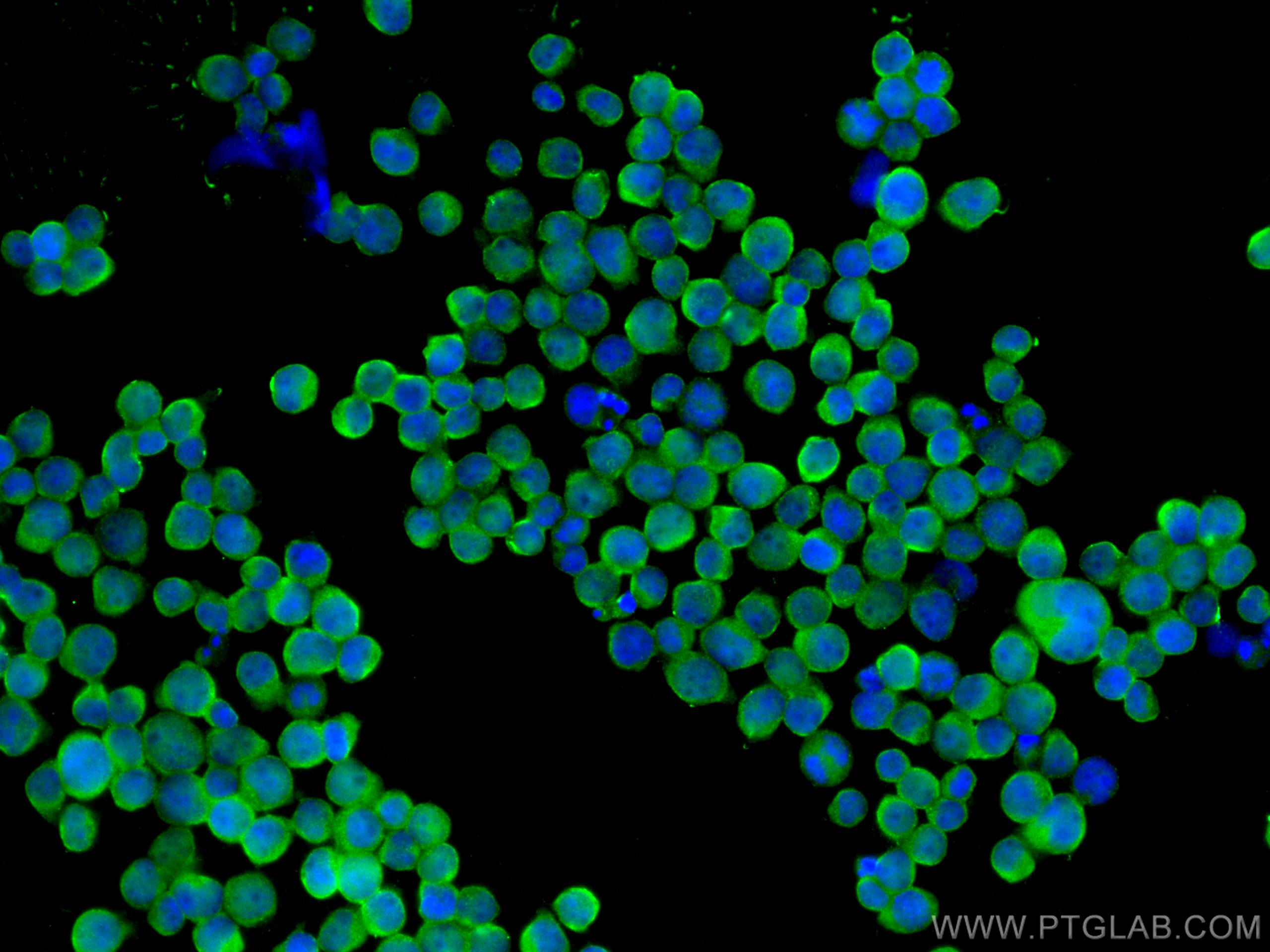 Immunofluorescence (IF) / fluorescent staining of Jurkat cells using JNK Polyclonal antibody (24164-1-AP)
