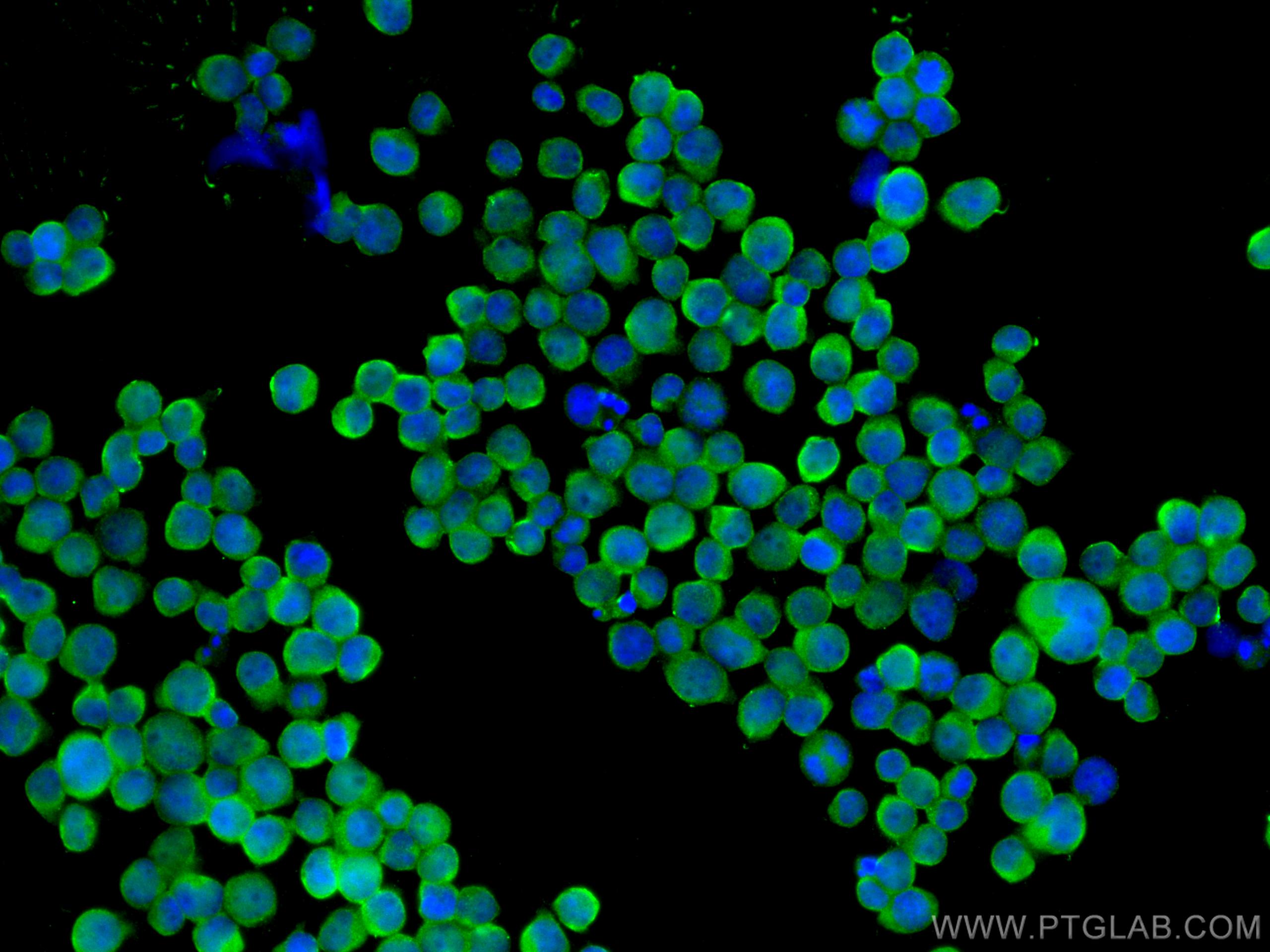 IF Staining of Jurkat using 24164-1-AP