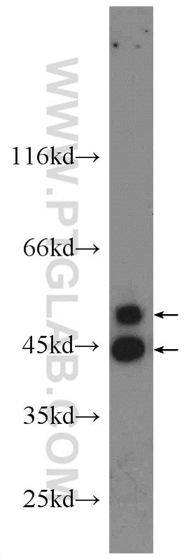 Western Blot (WB) analysis of HEK-293 cells using JNK Polyclonal antibody (24164-1-AP)