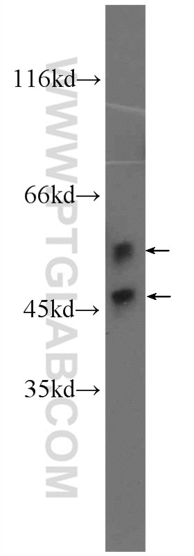 Western Blot (WB) analysis of HeLa cells using JNK Polyclonal antibody (24164-1-AP)