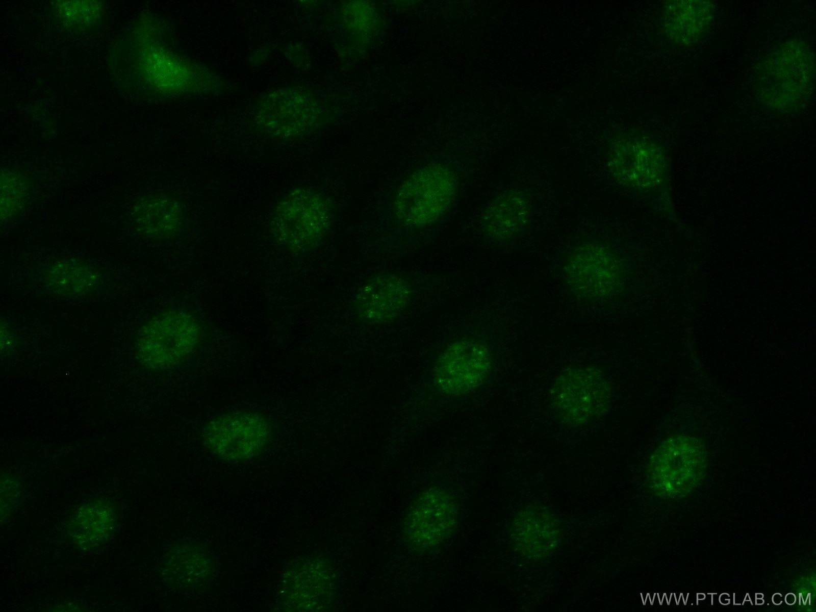 Immunofluorescence (IF) / fluorescent staining of SH-SY5Y cells using JNK Polyclonal antibody (51151-1-AP)