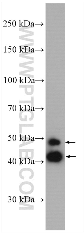 Western Blot (WB) analysis of mouse brain tissue using JNK Polyclonal antibody (51151-1-AP)