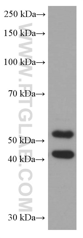 JNK Monoclonal antibody